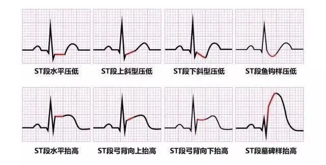 孕32周到34周心脏负荷最大就是危险期吗？