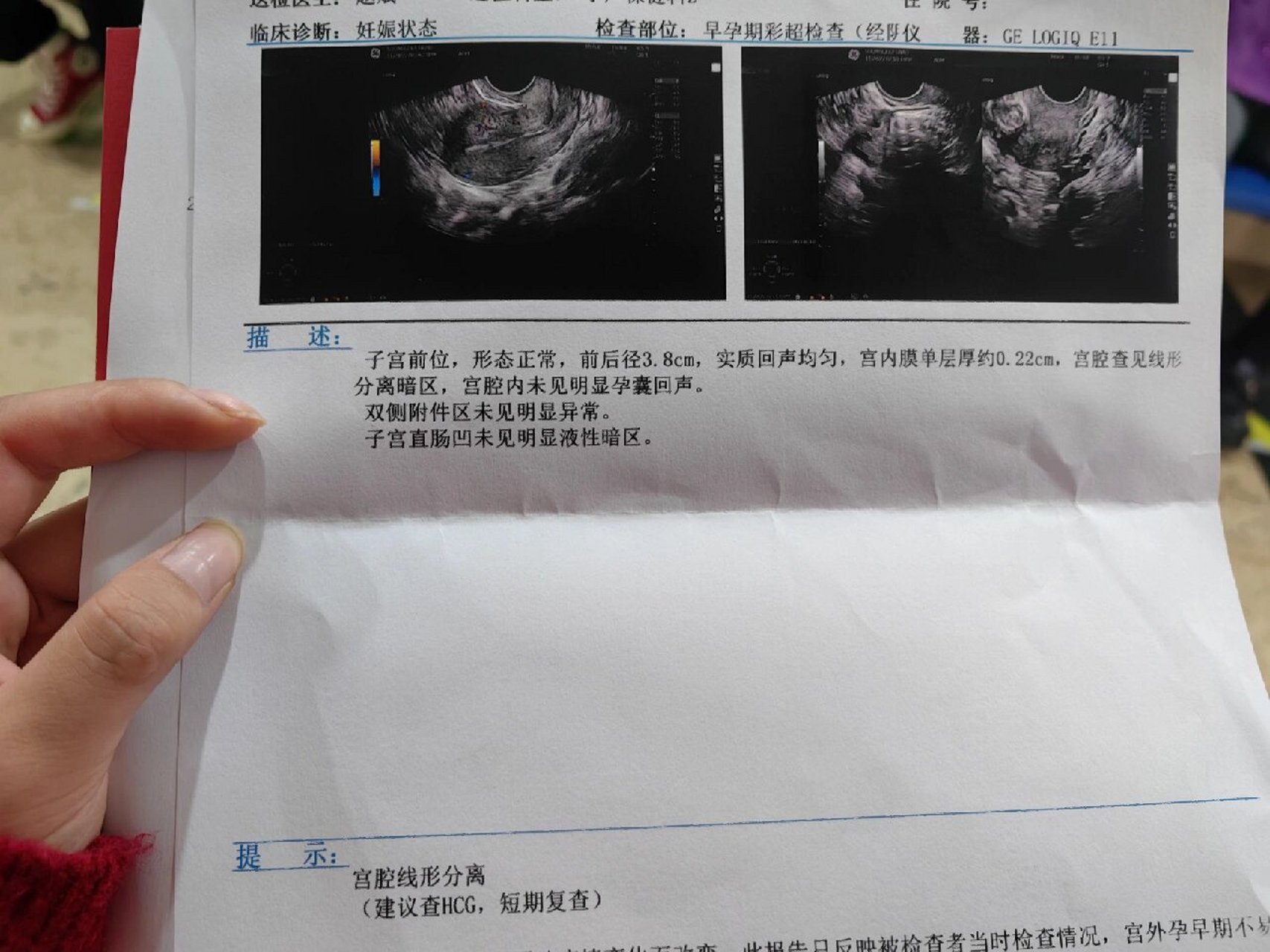 试管移植后hcg和孕酮低怎么办?调整饮食和作息或许有用