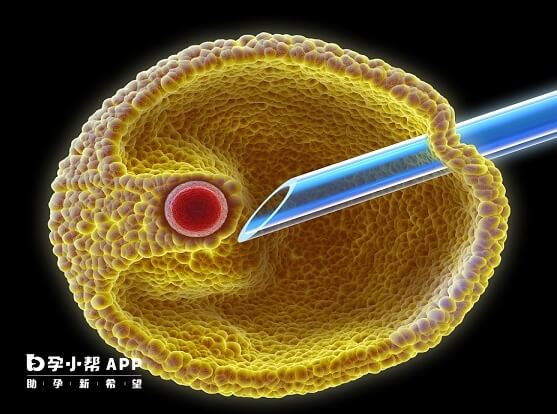 试管婴儿不在连云港医保报销范围内