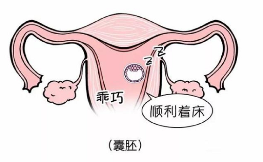 移植两个胚胎都没成功着床是因为胚胎质量差吗？