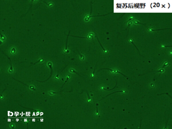 供精的精子质量是合格的