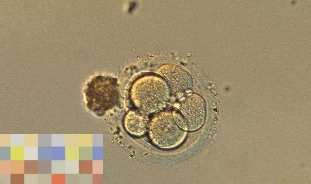 试管婴儿攒胚胎可提高成功率