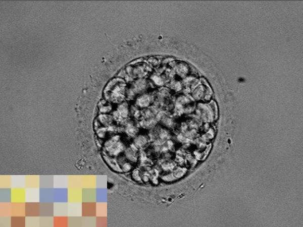 嵌合体胚胎移植有风险