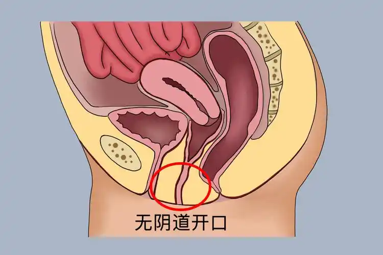 石女从哪可以看出来？从外表能看出吗？